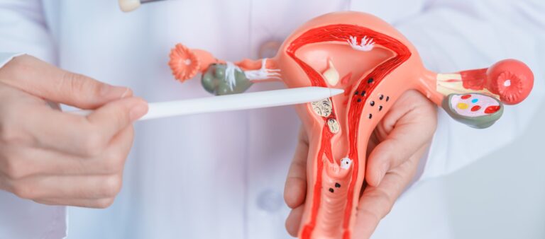 Doctor holding Uterus and Ovaries model.